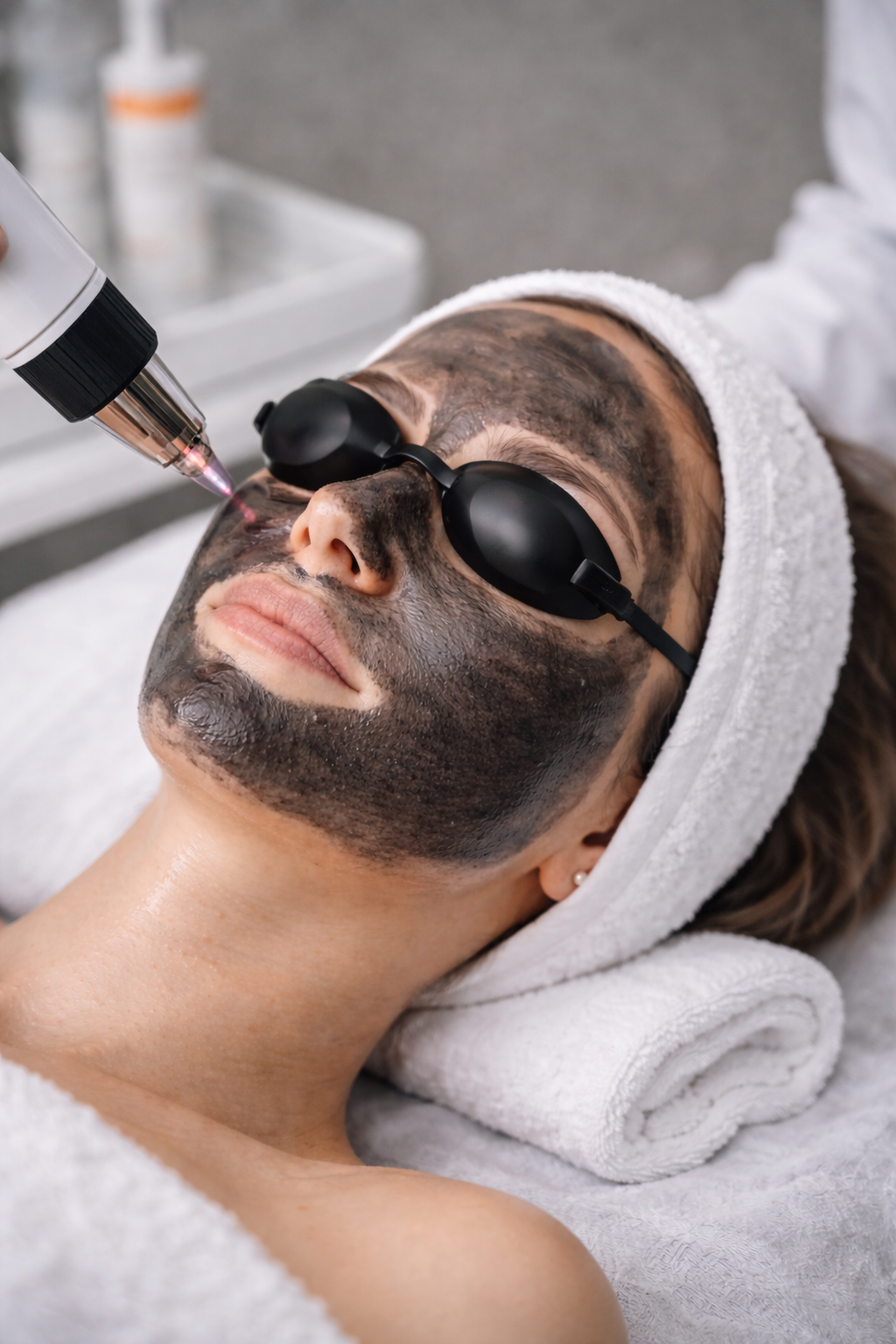 Карбоновый пилинг