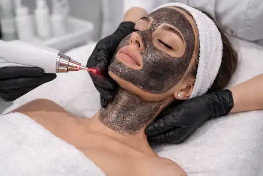 Карбоновый пилинг лица и шеи