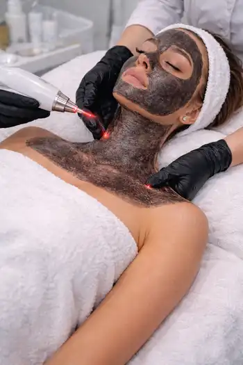 Карбоновый пилинг лица шеи и декольте